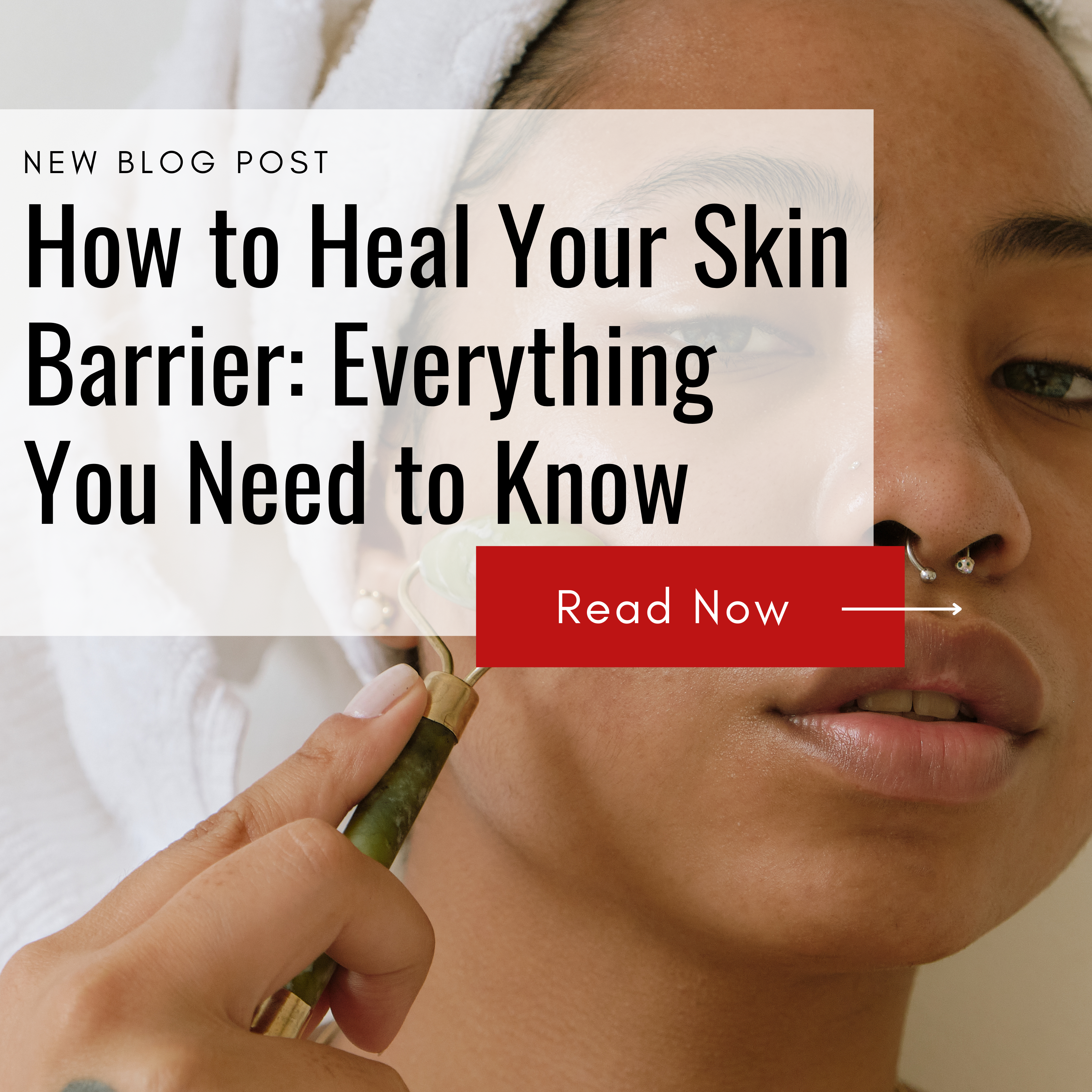 How to Heal Your Skin Barrier: Everything You Need to Know