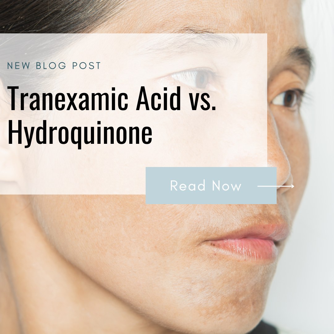 Tranexamic Acid: The Gentle Alternative to Hydroquinone for Brightening and Hyperpigmentation