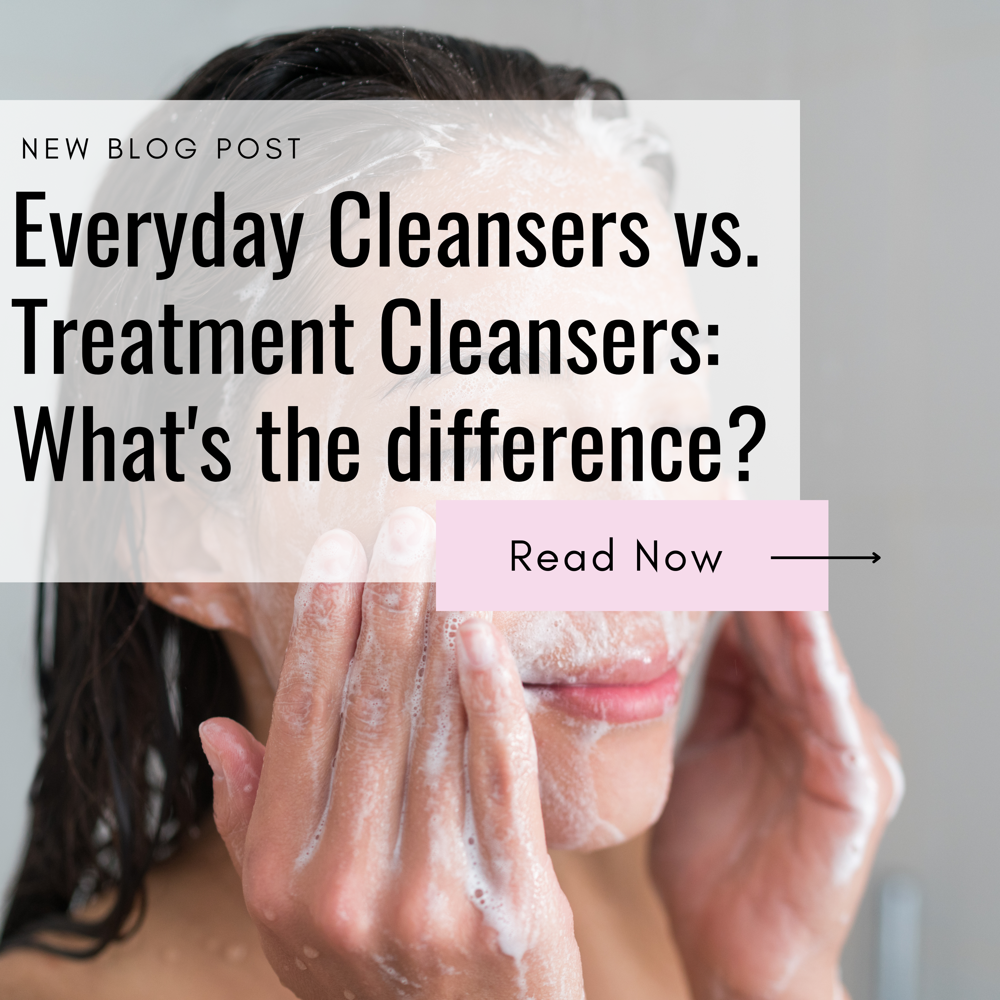 Understanding the Difference Between Everyday Cleansers and Treatment Cleansers